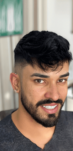 After hair patch transformation with fuller, natural-looking hair in Aurangabad